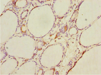DTX2 Antibody - Immunohistochemistry of paraffin-embedded human thyroid tissue at dilution 1:100