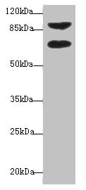 DTX2 Antibody - Western blot All Lanes: DTX2 antibody at 1ug/ml+ HepG-2 whole cell lysate Goat polyclonal to rabbit at 1/10000 dilution Predicted band size: 68,63 kDa Observed band size: 67 kDa,92Da