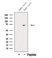 DTX2 Antibody - Western blot analysis of extracts of human testis tissue using DTX2 antibody. The lane on the left was treated with blocking peptide.