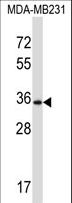 DTX3 Antibody - DTX3 Antibody (N-term ) western blot of MDA-MB231 cell line lysates (35 ug/lane). The DTX3 antibody detected the DTX3 protein (arrow).
