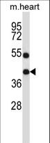DTX3 Antibody - DTX3 Antibody (N-term ) western blot of mouse heart tissue lysates (35 ug/lane). The DTX3 antibody detected the DTX3 protein (arrow).