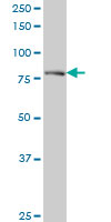 DTX3L Antibody - DTX3L monoclonal antibody (M01), clone 1D10 Western Blot analysis of DTX3L expression in A-431.