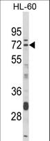 DTX4 Antibody - Western blot of DTX4 Antibody in HL-60 cell line lysates (35 ug/lane). DTX4 (arrow) was detected using the purified antibody.