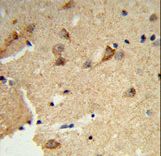DTX4 Antibody - Formalin-fixed and paraffin-embedded human brain tissue reacted with DTX4 Antibody , which was peroxidase-conjugated to the secondary antibody, followed by DAB staining. This data demonstrates the use of this antibody for immunohistochemistry; clinical relevance has not been evaluated.