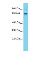 DTX4 Antibody - Western blot of DTX4 Antibody - C-terminal region with human Fetal Kidney cells lysate.  This image was taken for the unconjugated form of this product. Other forms have not been tested.
