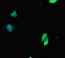 DTX4 Antibody - Immunofluorescent analysis of HepG2 cells diluted at 1:100 and Alexa Fluor 488-congugated AffiniPure Goat Anti-Rabbit IgG(H+L)