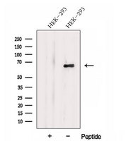 DTX4 Antibody - Western blot analysis of extracts of HEK293 cells using DTX4 antibody. The lane on the left was treated with blocking peptide.