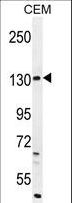 DUOX2 Antibody - DUOX2 Antibody western blot of CEM cell line lysates (35 ug/lane). The DUOX2 antibody detected the DUOX2 protein (arrow).