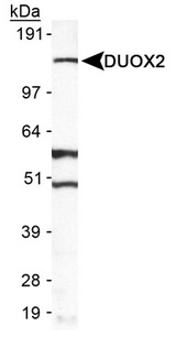 DUOX2 Antibody - Detection of DUOX2 in A549 in cell lysate.  This image was taken for the unconjugated form of this product. Other forms have not been tested.