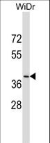 DUOXA2 Antibody - DUOXA2 Antibody western blot of WiDr cell line lysates (35 ug/lane). The DUOXA2 antibody detected the DUOXA2 protein (arrow).