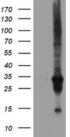 DUPD1 Antibody - HEK293T cells were transfected with the pCMV6-ENTRY control (Left lane) or pCMV6-ENTRY DUPD1 (Right lane) cDNA for 48 hrs and lysed. Equivalent amounts of cell lysates (5 ug per lane) were separated by SDS-PAGE and immunoblotted with anti-DUPD1.