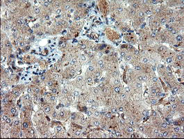 DUPD1 Antibody - IHC of paraffin-embedded Human liver tissue using anti-DUPD1 mouse monoclonal antibody.