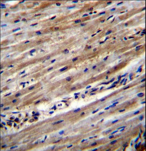 DUS1L Antibody - DUS1L Antibody immunohistochemistry of formalin-fixed and paraffin-embedded human heart tissue followed by peroxidase-conjugated secondary antibody and DAB staining.