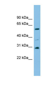 DUS1L Antibody - DUS1L antibody Western blot of Fetal brain lysate. This image was taken for the unconjugated form of this product. Other forms have not been tested.