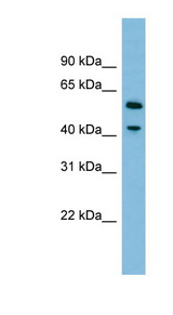 DUS1L Antibody - DUS1L antibody Western blot of HepG2 cell lysate. This image was taken for the unconjugated form of this product. Other forms have not been tested.