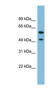 DUS1L Antibody - DUS1L antibody Western blot of HepG2 cell lysate. This image was taken for the unconjugated form of this product. Other forms have not been tested.