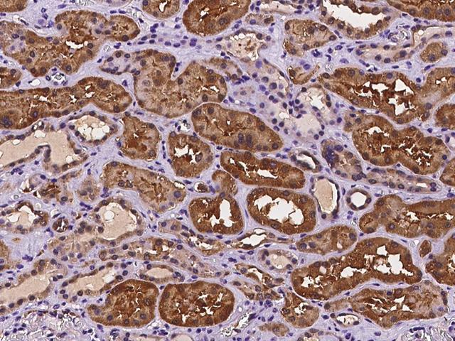 DUS1L Antibody - Immunochemical staining of human DUS1L in human kidney with rabbit polyclonal antibody at 1:100 dilution, formalin-fixed paraffin embedded sections.
