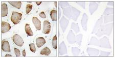 DUS2 / DUS2L Antibody - Immunohistochemistry analysis of paraffin-embedded human skeletal muscle tissue, using DUS2L Antibody. The picture on the right is blocked with the synthesized peptide.