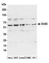 DUS2 / DUS2L Antibody - Detection of human and mouse DUS2 by western blot. Samples: Whole cell lysate (15 µg) from HeLa, HEK293T, Jurkat, mouse TCMK-1, and mouse NIH 3T3 cells prepared using NETN lysis buffer. Antibody: Affinity purified rabbit anti-DUS2 antibody used for WB at 0.04 µg/ml. Detection: Chemiluminescence with an exposure time of 30 seconds.