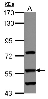 DUS2 / DUS2L Antibody - Sample (30 ug of whole cell lysate) A: A549 7.5% SDS PAGE DUS2L antibody diluted at 1:1000