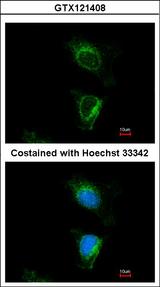 DUS2 / DUS2L Antibody - Immunofluorescence of methanol-fixed HeLa, using DUS2L antibody at 1:500 dilution.