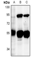 DUS2 / DUS2L Antibody - Western blot analysis of DUS2L expression in HCT116 (A), mouse lung (B), rat lung (C) whole cell lysates.