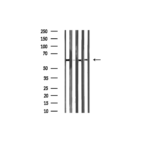 DUS2 / DUS2L Antibody - Western blot analysis of extracts of various tissue sample using DUS2L antibody.