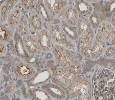 DUS2 / DUS2L Antibody - 1:100 staining human kidney tissue by IHC-P. The tissue was formaldehyde fixed and a heat mediated antigen retrieval step in citrate buffer was performed. The tissue was then blocked and incubated with the antibody for 1.5 hours at 22°C. An HRP conjugated goat anti-rabbit antibody was used as the secondary.