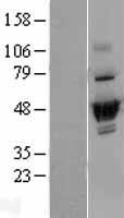 DUS2 / DUS2L Protein - Western validation with an anti-DDK antibody * L: Control HEK293 lysate R: Over-expression lysate