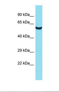 DUS3L Antibody - Western blot of Human PANC1. DUS3L antibody dilution 1.0 ug/ml.  This image was taken for the unconjugated form of this product. Other forms have not been tested.