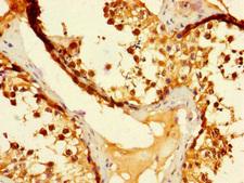 DUS3L Antibody - Immunohistochemistry of paraffin-embedded human testis tissue using DUS3L Antibody at dilution of 1:100