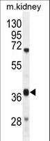 DUS4L Antibody - DUS4L Antibody western blot of mouse kidney tissue lysates (35 ug/lane). The DUS4L antibody detected the DUS4L protein (arrow).