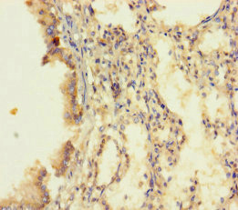 DUS4L Antibody - Immunohistochemistry of paraffin-embedded human lung tissue using DUS4L Antibody at dilution of 1:100
