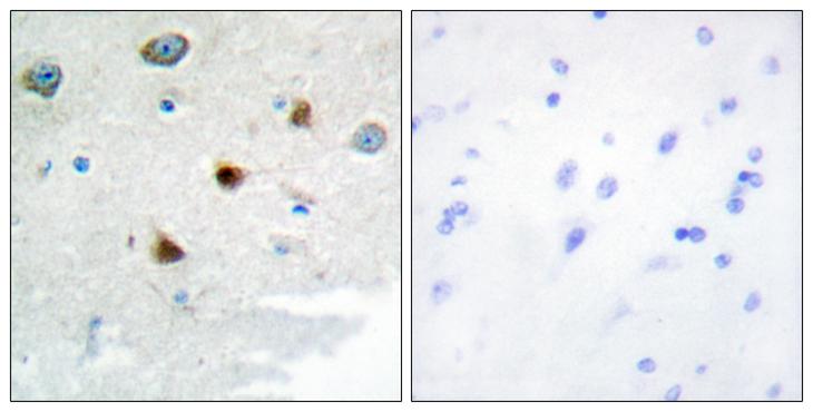 DUS4L Antibody - Peptide - + Immunohistochemistry analysis of paraffin-embedded human brain tissue using DUS4 antibody.