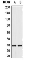 DUSP1 + DUSP4 Antibody - Western blot analysis of DUSP1/4 expression in HeLa (A); Jurkat (B) whole cell lysates.