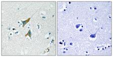 DUSP1 / MKP1 Antibody - Immunohistochemistry analysis of paraffin-embedded human brain tissue, using MKP1 Antibody. The picture on the right is blocked with the synthesized peptide.