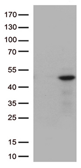 DUSP1 / MKP1 Antibody - HEK293T cells were transfected with the pCMV6-ENTRY control. (Left lane) or pCMV6-ENTRY DUSP1. (Right lane) cDNA for 48 hrs and lysed. Equivalent amounts of cell lysates. (5 ug per lane) were separated by SDS-PAGE and immunoblotted with anti-DUSP1. (1:500)