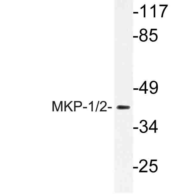 DUSP1 / MKP1 Antibody - Western blot of MKP-1/2 (Q290) pAb in extracts from Jurkat cells.