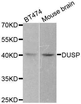 DUSP1 / MKP1 Antibody - Western blot analysis of extracts of various cell lines, using DUSP1 antibody.