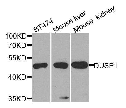 DUSP1 / MKP1 Antibody - Western blot analysis of extracts of various cell lines.