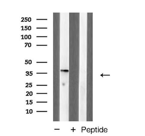 DUSP1 / MKP1 Antibody - Western blot analysis of MKP1 expression in Jurkat cells extracts
