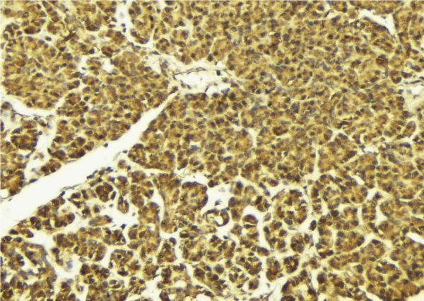 DUSP1 / MKP1 Antibody - 1:100 staining mouse pancreas tissue by IHC-P. The sample was formaldehyde fixed and a heat mediated antigen retrieval step in citrate buffer was performed. The sample was then blocked and incubated with the antibody for 1.5 hours at 22°C. An HRP conjugated goat anti-rabbit antibody was used as the secondary.
