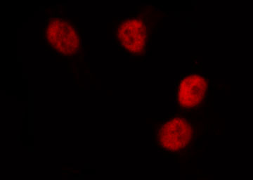 DUSP1 / MKP1 Antibody - Staining HeLa cells by IF/ICC. The samples were fixed with PFA and permeabilized in 0.1% Triton X-100, then blocked in 10% serum for 45 min at 25°C. The primary antibody was diluted at 1:200 and incubated with the sample for 1 hour at 37°C. An Alexa Fluor 594 conjugated goat anti-rabbit IgG (H+L) antibody, diluted at 1/600, was used as secondary antibody.