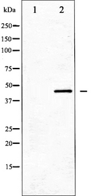DUSP1 / MKP1 Antibody - Western blot analysis of MKP-1/2 expression in Jurkat whole cells lysates. The lane on the left is treated with the antigen-specific peptide.