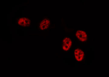 DUSP1 / MKP1 Antibody - Staining HeLa cells by IF/ICC. The samples were fixed with PFA and permeabilized in 0.1% Triton X-100, then blocked in 10% serum for 45 min at 25°C. The primary antibody was diluted at 1:200 and incubated with the sample for 1 hour at 37°C. An Alexa Fluor 594 conjugated goat anti-rabbit IgG (H+L) Ab, diluted at 1/600, was used as the secondary antibody.