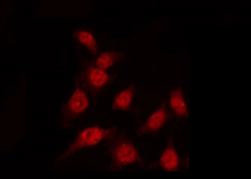 DUSP1 / MKP1 Antibody - Staining K562 cells by IF/ICC. The samples were fixed with PFA and permeabilized in 0.1% Triton X-100, then blocked in 10% serum for 45 min at 25°C. The primary antibody was diluted at 1:200 and incubated with the sample for 1 hour at 37°C. An Alexa Fluor 594 conjugated goat anti-rabbit IgG (H+L) Ab, diluted at 1/600, was used as the secondary antibody.
