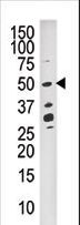 DUSP10 / MKP5 Antibody - Western blot of anti-DUSP10 antibody in CEM cell line tissue lysate (35 ug/lane). DUSP10(arrow) was detected using the purified antibody.