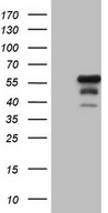 DUSP10 / MKP5 Antibody - HEK293T cells were transfected with the pCMV6-ENTRY control (Left lane) or pCMV6-ENTRY DUSP10 (Right lane) cDNA for 48 hrs and lysed. Equivalent amounts of cell lysates (5 ug per lane) were separated by SDS-PAGE and immunoblotted with anti-DUSP10.