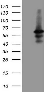 DUSP10 / MKP5 Antibody - HEK293T cells were transfected with the pCMV6-ENTRY control. (Left lane) or pCMV6-ENTRY DUSP10. (Right lane) cDNA for 48 hrs and lysed