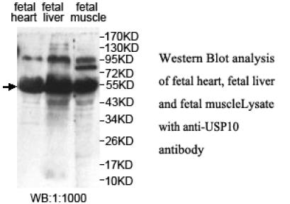 DUSP10 / MKP5 Antibody